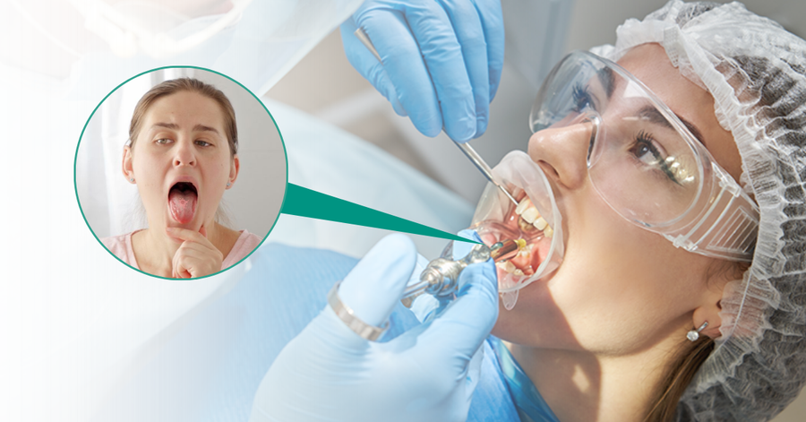 condition for oral cancer treatment